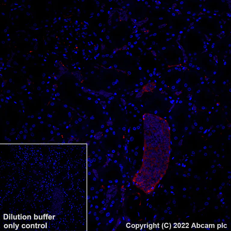 Immunohistochemistry (Formalin/PFA-fixed paraffin-embedded sections) - Alexa Fluor® 647 Anti-Apolipoprotein E antibody [EP1373Y] (AB307392)