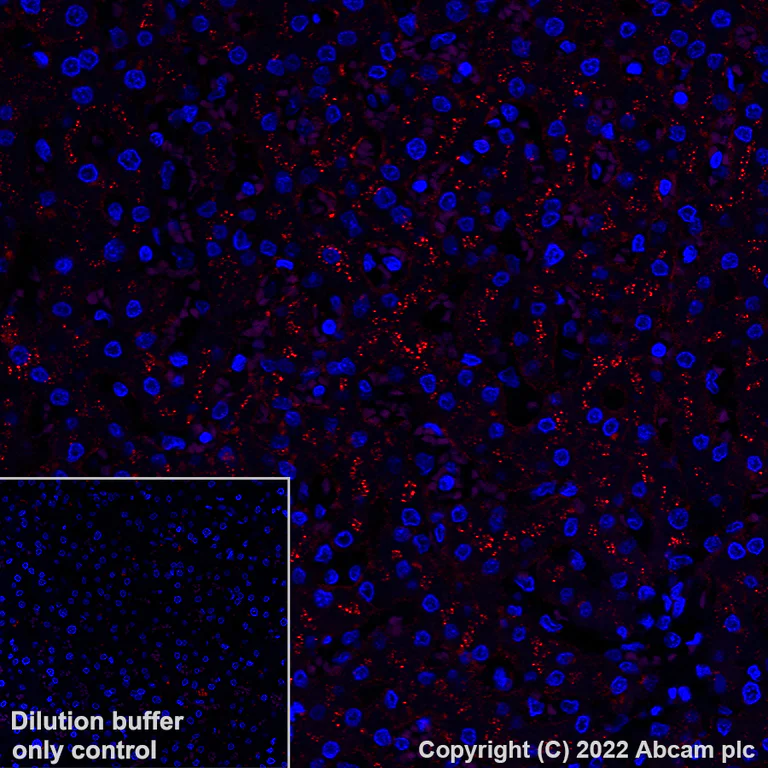 Immunohistochemistry (Formalin/PFA-fixed paraffin-embedded sections) - Alexa Fluor® 647 Anti-Apolipoprotein E antibody [EP1373Y] (AB307392)