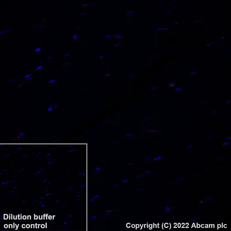 Immunohistochemistry (Formalin/PFA-fixed paraffin-embedded sections) - Alexa Fluor® 647 Anti-Apolipoprotein E antibody [EP1373Y] (AB307392)