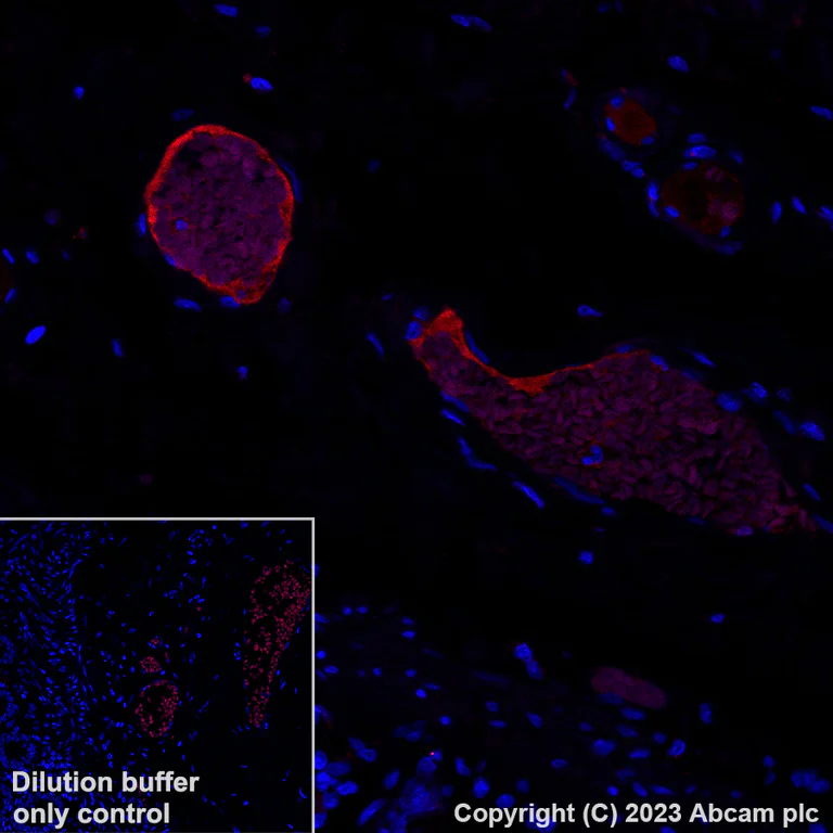 Immunohistochemistry (Formalin/PFA-fixed paraffin-embedded sections) - Alexa Fluor® 647 Anti-Apolipoprotein L1/APOL1 antibody [EPRBOB-2-F1-17] (AB314508)