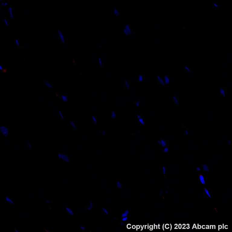 Immunohistochemistry (Formalin/PFA-fixed paraffin-embedded sections) - Alexa Fluor® 647 Anti-Apolipoprotein L1/APOL1 antibody [EPRBOB-2-F1-17] (AB314508)