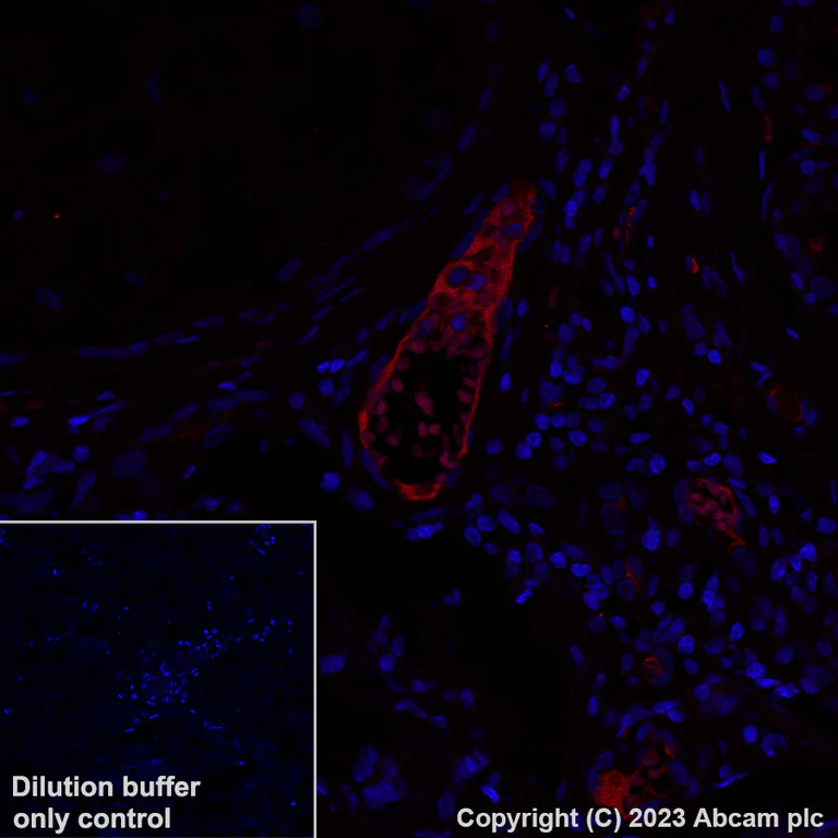 Immunohistochemistry (Formalin/PFA-fixed paraffin-embedded sections) - Alexa Fluor® 647 Anti-Apolipoprotein L1/APOL1 antibody [EPRBOB-2-F1-17] (AB314508)