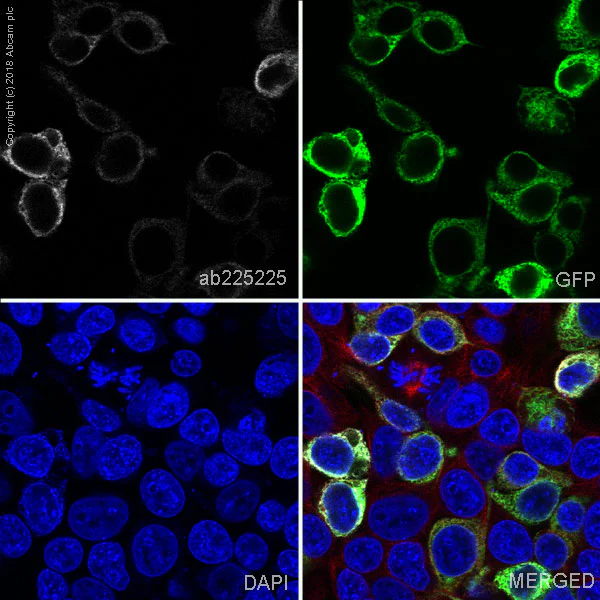 Immunocytochemistry/ Immunofluorescence - Alexa Fluor® 647 Anti-Aquaporin 1 antibody [EPR11588(B)] (AB225225)