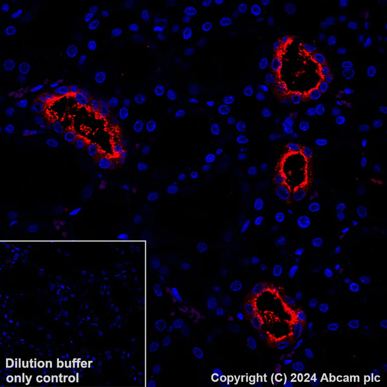 Immunohistochemistry (Formalin/PFA-fixed paraffin-embedded sections) - Alexa Fluor® 647 Anti-Aquaporin 2 antibody [EPR21080] (AB323996)