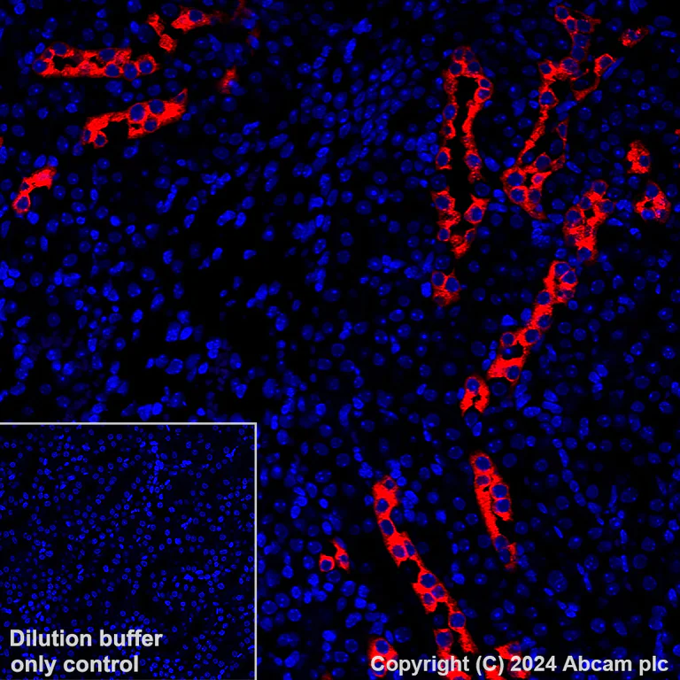 Immunohistochemistry (Formalin/PFA-fixed paraffin-embedded sections) - Alexa Fluor® 647 Anti-Aquaporin 2 antibody [EPR21080] (AB323996)