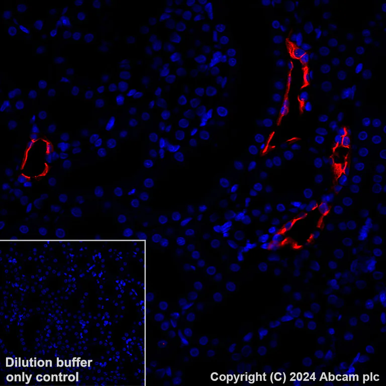 Immunohistochemistry (Formalin/PFA-fixed paraffin-embedded sections) - Alexa Fluor® 647 Anti-Aquaporin 2 antibody [EPR21080] (AB323996)