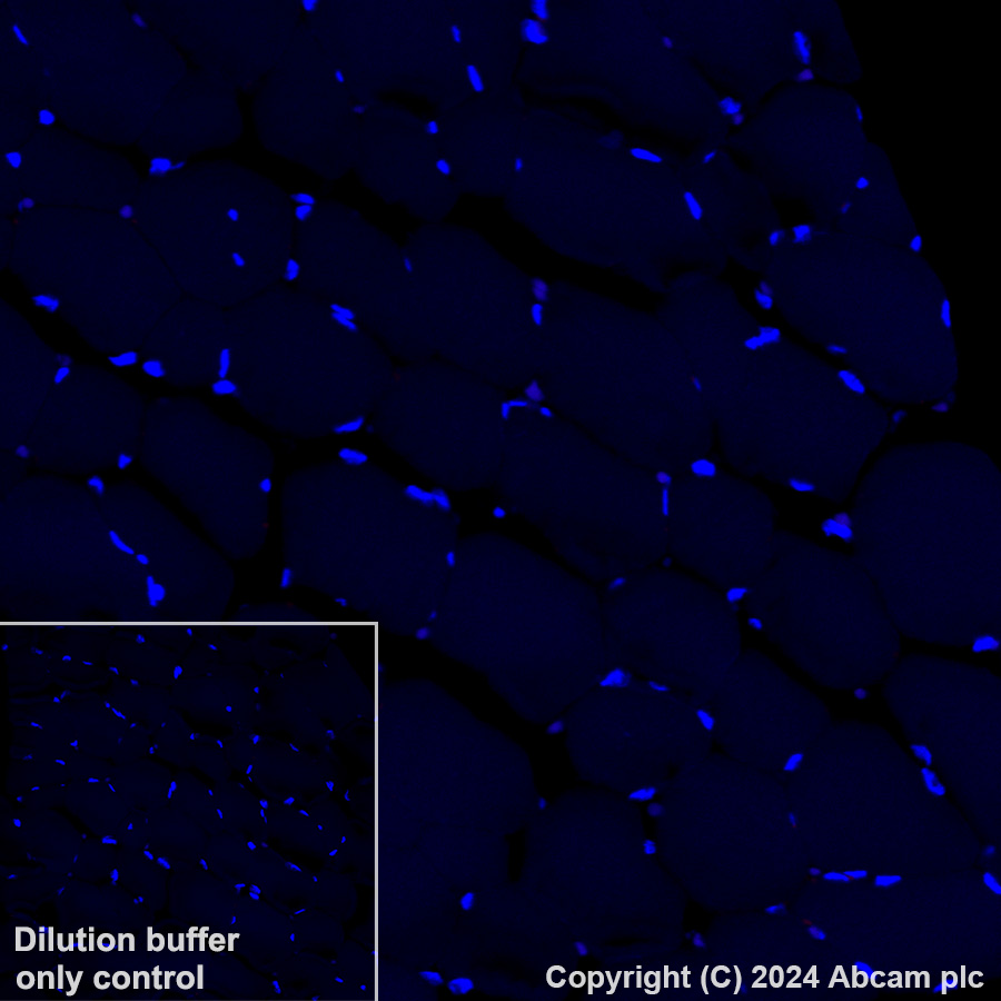 Immunohistochemistry (Formalin/PFA-fixed paraffin-embedded sections) - Alexa Fluor® 647 Anti-Aquaporin 2 antibody [EPR21080] (AB323996), expandable thumbnail