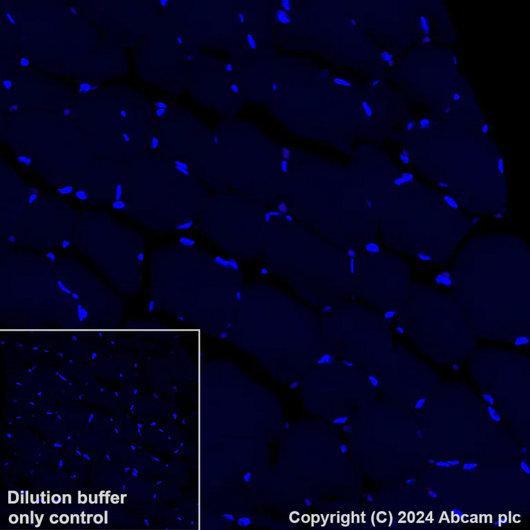 Immunohistochemistry (Formalin/PFA-fixed paraffin-embedded sections) - Alexa Fluor® 647 Anti-Aquaporin 2 antibody [EPR21080] (AB323996)