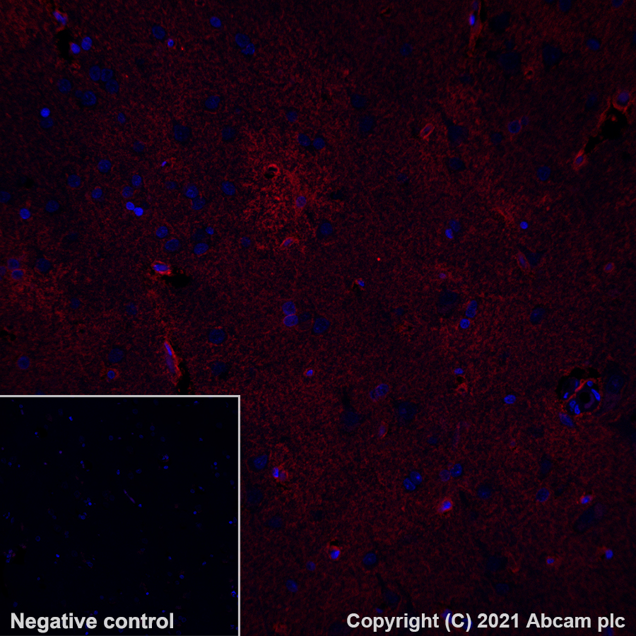 Élisaページ Biotinylated Human OX40 / TNFRSF4 / CD134 Protein, Avitag