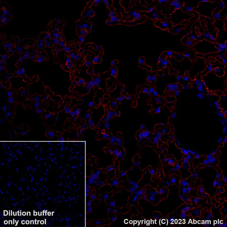 Immunohistochemistry (Formalin/PFA-fixed paraffin-embedded sections) - Alexa Fluor® 647 Anti-Aquaporin 5 antibody [EPR27474-70] (AB316344)