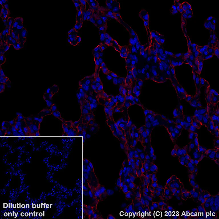 Immunohistochemistry (Formalin/PFA-fixed paraffin-embedded sections) - Alexa Fluor® 647 Anti-Aquaporin 5 antibody [EPR27474-70] (AB316344)