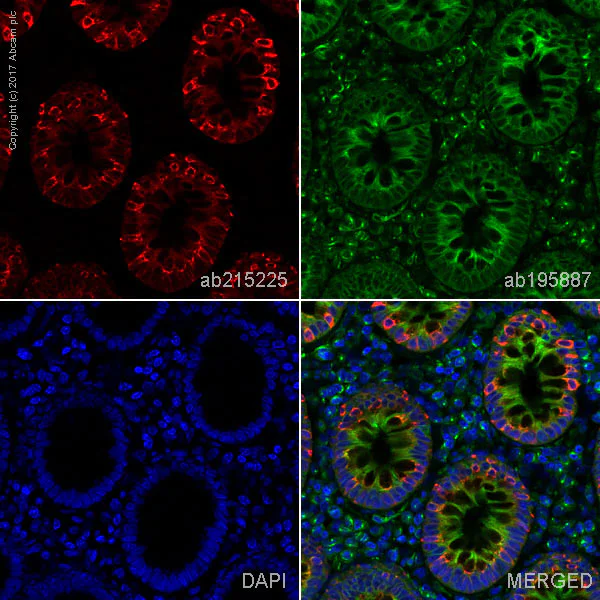 Immunohistochemistry (Formalin/PFA-fixed paraffin-embedded sections) - Alexa Fluor® 647 Anti-Aquaporin 5 antibody [EPR3747] (AB215225)