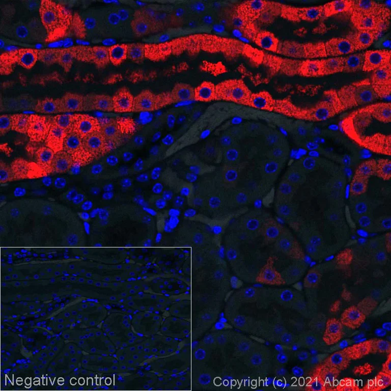 Immunohistochemistry (Formalin/PFA-fixed paraffin-embedded sections) - Alexa Fluor® 647 Anti-Arg2 antibody [EPR22626-38] (AB281324)