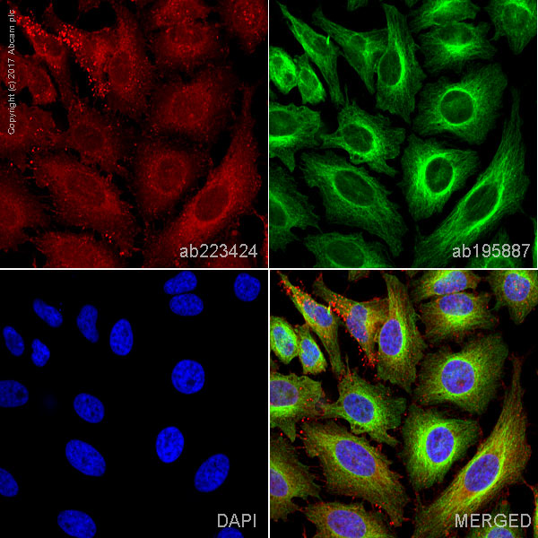 Immunocytochemistry/ Immunofluorescence - Alexa Fluor® 647 Anti-ARPC2 antibody [EPR8533] (AB223424)