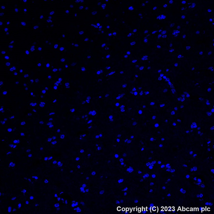 Immunohistochemistry (Formalin/PFA-fixed paraffin-embedded sections) - Alexa Fluor® 647 Anti-Asialoglycoprotein Receptor 1/HL-1 antibody [EPR22642-17] (AB315185), expandable thumbnail
