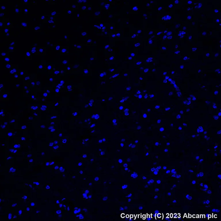 Immunohistochemistry (Formalin/PFA-fixed paraffin-embedded sections) - Alexa Fluor® 647 Anti-Asialoglycoprotein Receptor 1/HL-1 antibody [EPR22642-17] (AB315185)