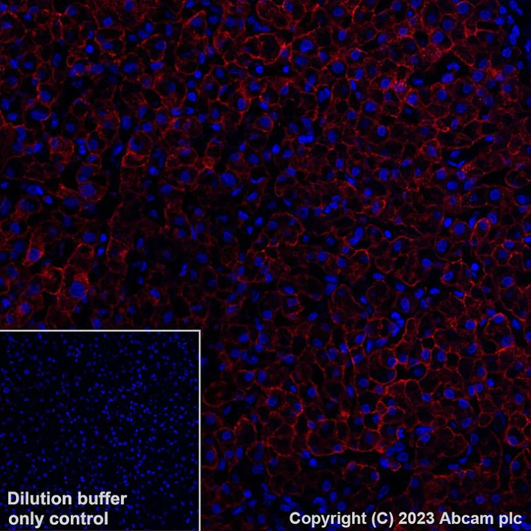 Immunohistochemistry (Formalin/PFA-fixed paraffin-embedded sections) - Alexa Fluor® 647 Anti-Asialoglycoprotein Receptor 1/HL-1 antibody [EPR22642-17] (AB315185)