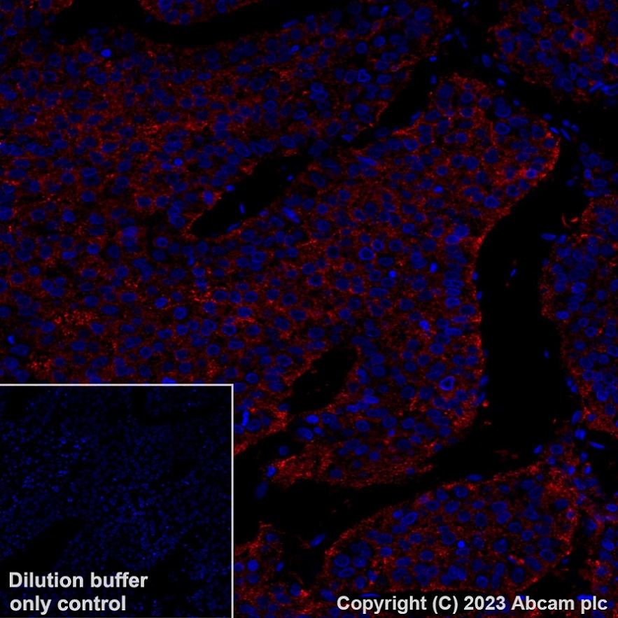 Immunohistochemistry (Formalin/PFA-fixed paraffin-embedded sections) - Alexa Fluor® 647 Anti-Asialoglycoprotein Receptor 1/HL-1 antibody [EPR22642-17] (AB315185), expandable thumbnail