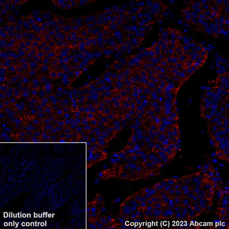 Immunohistochemistry (Formalin/PFA-fixed paraffin-embedded sections) - Alexa Fluor® 647 Anti-Asialoglycoprotein Receptor 1/HL-1 antibody [EPR22642-17] (AB315185)