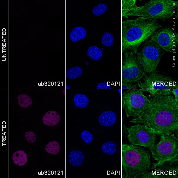 Immunocytochemistry/ Immunofluorescence - Alexa Fluor® 647 Anti-ATM (phospho S1987) antibody [EPR28058-71] (AB320121)