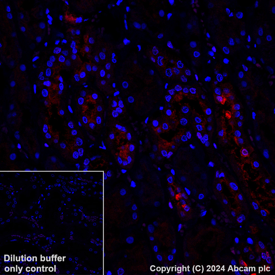 Immunohistochemistry (Formalin/PFA-fixed paraffin-embedded sections) - Alexa Fluor® 647 Anti-ATP6V1B1 + ATP6V1B2 antibody [EPR16401] (AB317528), expandable thumbnail