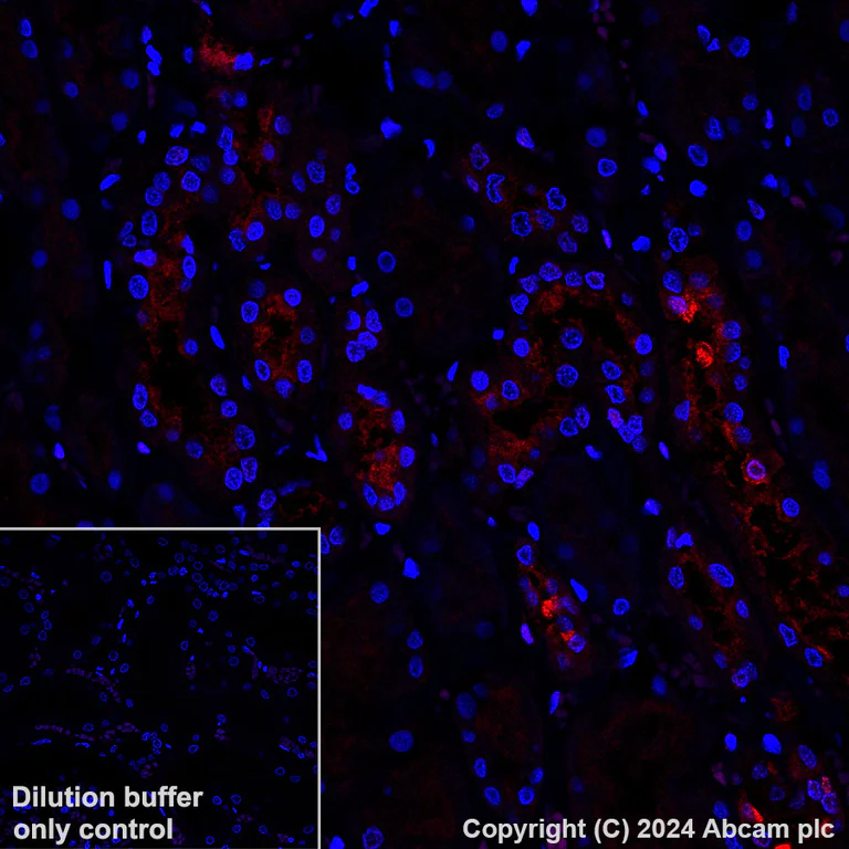 Immunohistochemistry (Formalin/PFA-fixed paraffin-embedded sections) - Alexa Fluor® 647 Anti-ATP6V1B1 + ATP6V1B2 antibody [EPR16401] (AB317528)
