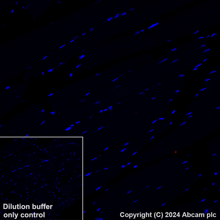 Immunohistochemistry (Formalin/PFA-fixed paraffin-embedded sections) - Alexa Fluor® 647 Anti-ATP6V1B1 + ATP6V1B2 antibody [EPR16401] (AB317528), expandable thumbnail