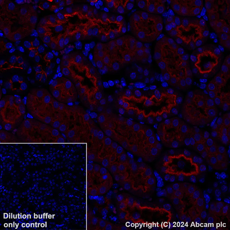 Immunohistochemistry (Formalin/PFA-fixed paraffin-embedded sections) - Alexa Fluor® 647 Anti-ATP6V1B1 + ATP6V1B2 antibody [EPR16401] (AB317528)