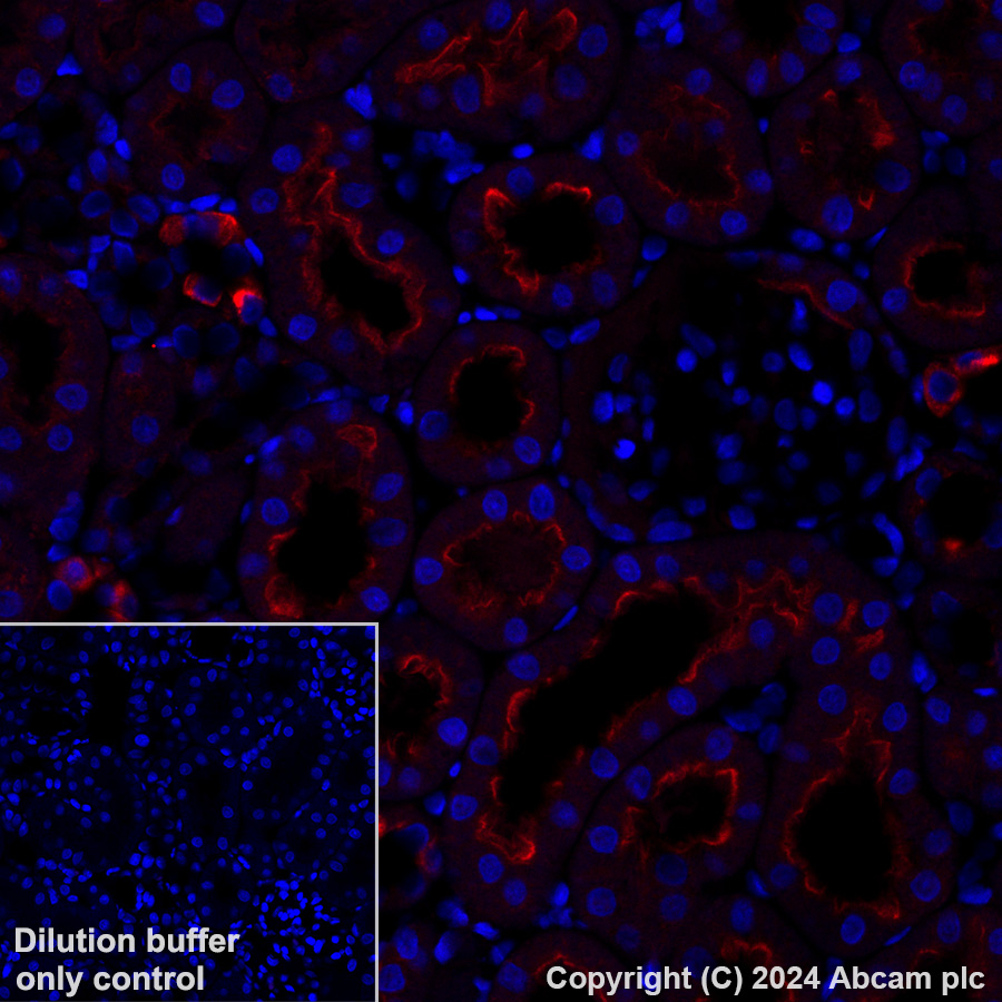 Immunohistochemistry (Formalin/PFA-fixed paraffin-embedded sections) - Alexa Fluor® 647 Anti-ATP6V1B1 + ATP6V1B2 antibody [EPR16401] (AB317528), expandable thumbnail