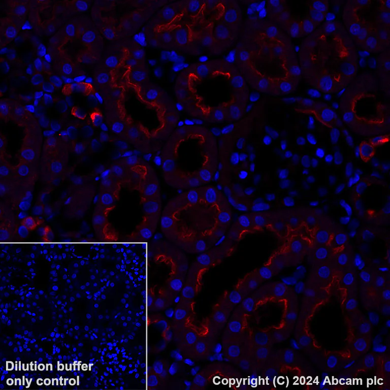 Immunohistochemistry (Formalin/PFA-fixed paraffin-embedded sections) - Alexa Fluor® 647 Anti-ATP6V1B1 + ATP6V1B2 antibody [EPR16401] (AB317528)