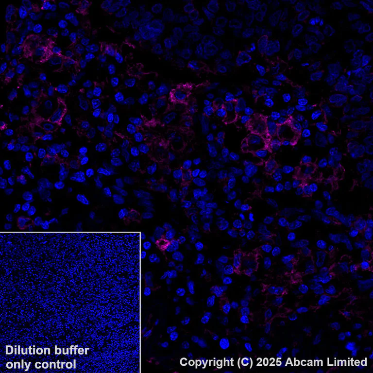 Immunohistochemistry (Formalin/PFA-fixed paraffin-embedded sections) - Alexa Fluor® 647 Anti-B7-H6 antibody [EPR28658-68] (AB325688)