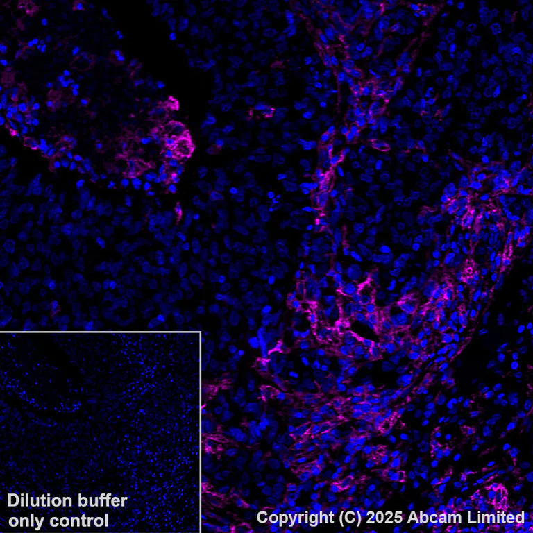 Immunohistochemistry (Formalin/PFA-fixed paraffin-embedded sections) - Alexa Fluor® 647 Anti-B7-H6 antibody [EPR28658-68] (AB325688)