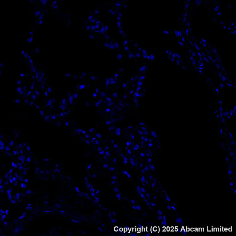 Immunohistochemistry (Formalin/PFA-fixed paraffin-embedded sections) - Alexa Fluor® 647 Anti-B7-H6 antibody [EPR28658-68] (AB325688)