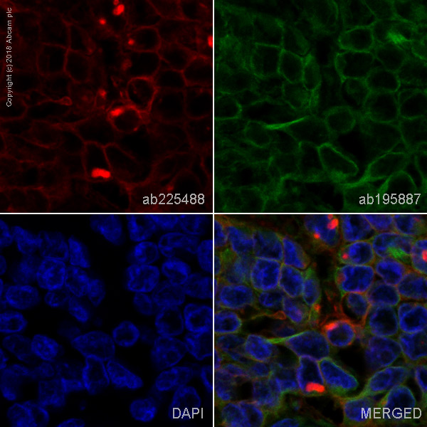 Immunohistochemistry (Formalin/PFA-fixed paraffin-embedded sections) - Alexa Fluor® 647 Anti-B7H4 antibody [EPR20236] (AB225488)