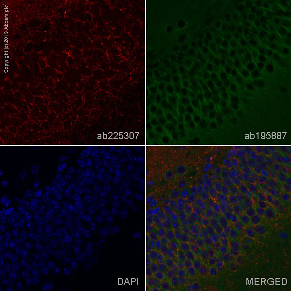 Immunohistochemistry (Formalin/PFA-fixed paraffin-embedded sections) - Alexa Fluor® 647 Anti-BACE1 antibody [EPR19523] (AB225307)