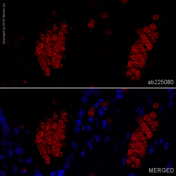 Immunohistochemistry (Formalin/PFA-fixed paraffin-embedded sections) - Alexa Fluor® 647 Anti-Band 3/AE 1 antibody [EPR1426] (AB225080)