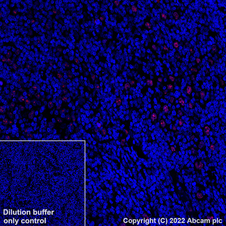 Immunohistochemistry (Formalin/PFA-fixed paraffin-embedded sections) - Alexa Fluor® 647 Anti-BATF3 antibody [EPR26558-38] (AB307471)