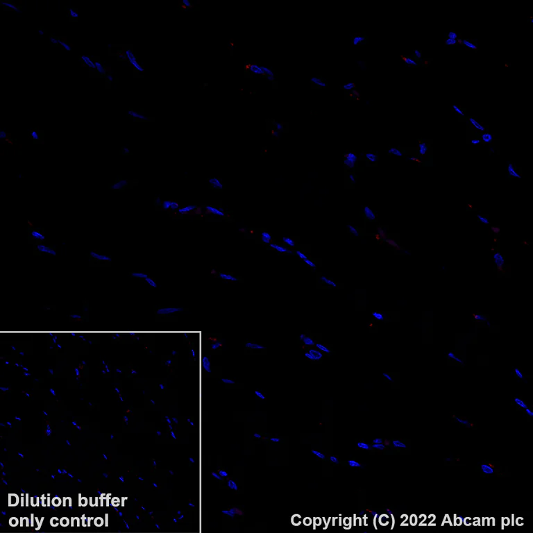 Immunohistochemistry (Formalin/PFA-fixed paraffin-embedded sections) - Alexa Fluor® 647 Anti-BATF3 antibody [EPR26558-38] (AB307471)