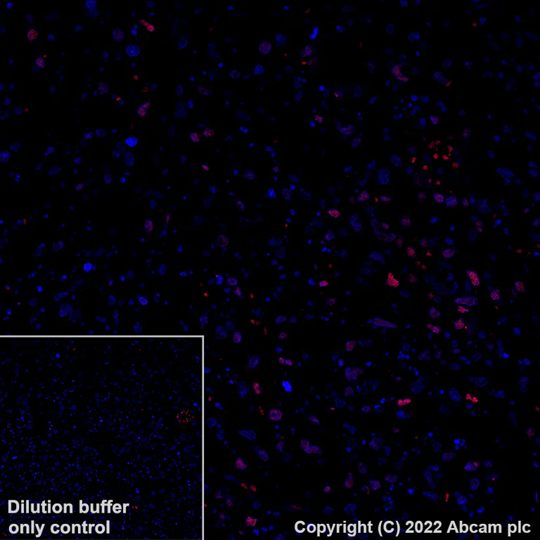 Immunohistochemistry (Formalin/PFA-fixed paraffin-embedded sections) - Alexa Fluor® 647 Anti-BATF3 antibody [EPR26558-38] (AB307471)