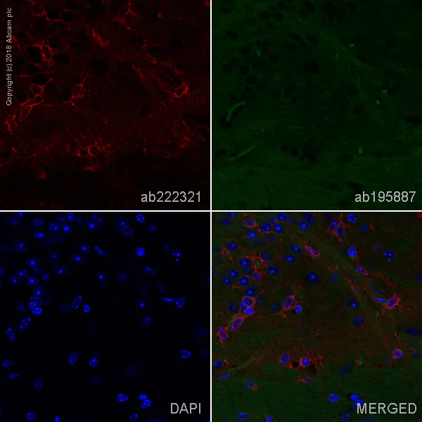 Immunohistochemistry (Formalin/PFA-fixed paraffin-embedded sections) - Alexa Fluor® 647 Anti-BDNF antibody [EPR1292] (AB222321)