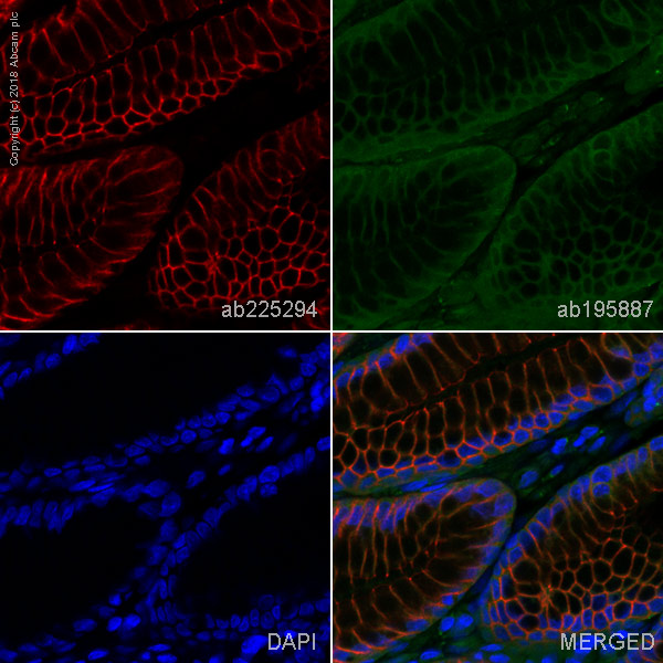 Immunohistochemistry (Formalin/PFA-fixed paraffin-embedded sections) - Alexa Fluor® 647 Anti-beta 2 Adrenergic Receptor antibody [EPR707(N)] (AB225294)