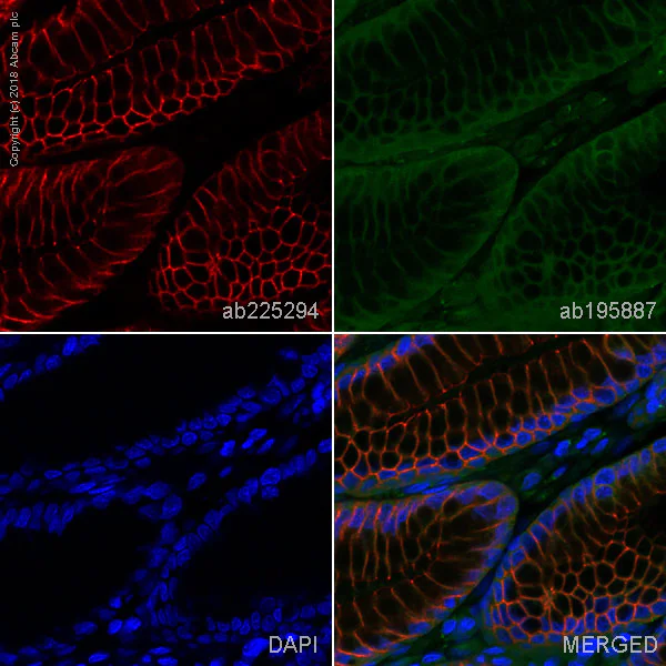 Immunohistochemistry (Formalin/PFA-fixed paraffin-embedded sections) - Alexa Fluor® 647 Anti-beta 2 Adrenergic Receptor antibody [EPR707(N)] (AB225294)