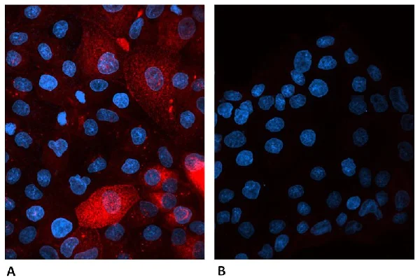 Immunocytochemistry/ Immunofluorescence - Alexa Fluor® 647 Anti-beta 2 Microglobulin antibody [B2M01] (AB187602)