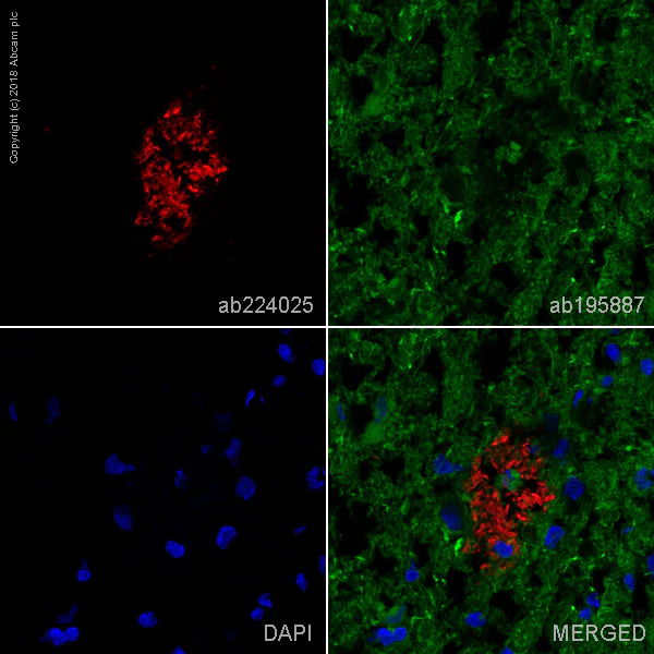 Alexa Fluor® 647 Anti-beta Amyloid 1-42 antibody [mOC64