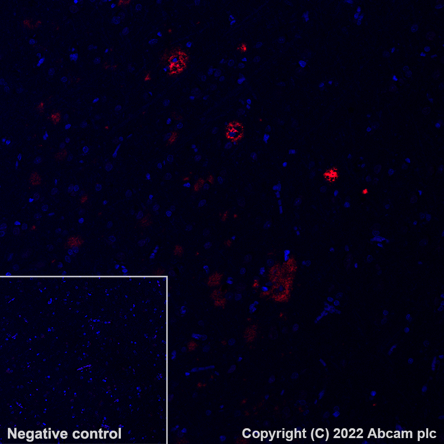 Immunohistochemistry (Formalin/PFA-fixed paraffin-embedded sections) - Alexa Fluor® 647 Anti-beta Amyloid 1-42 antibody [mOC64] (AB300742), expandable thumbnail