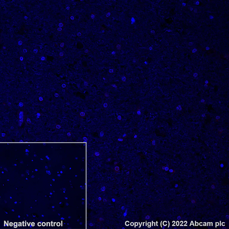 Immunohistochemistry (Formalin/PFA-fixed paraffin-embedded sections) - Alexa Fluor® 647 Anti-beta Amyloid 1-42 antibody [mOC64] (AB300742)