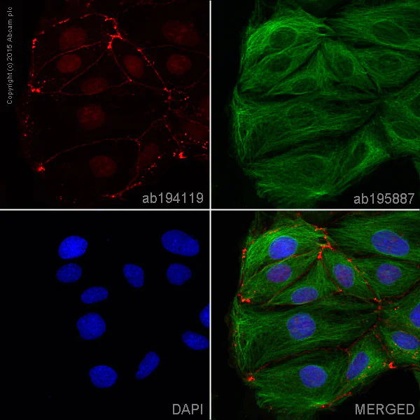 Immunocytochemistry/ Immunofluorescence - Alexa Fluor® 647 Anti-beta Catenin antibody [E247] (AB194119)