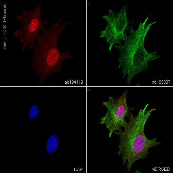Immunocytochemistry/ Immunofluorescence - Alexa Fluor® 647 Anti-beta Catenin antibody [E247] (AB194119)