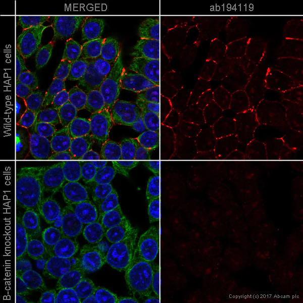 Immunocytochemistry/ Immunofluorescence - Alexa Fluor® 647 Anti-beta Catenin antibody [E247] (AB194119)