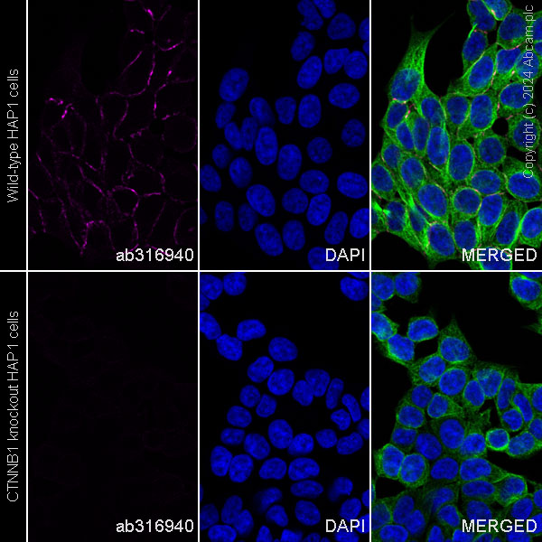 Immunocytochemistry/ Immunofluorescence - Alexa Fluor® 647 Anti-beta Catenin non-phospho(active) S45 antibody [EPR26155-110-1] (AB316940), expandable thumbnail